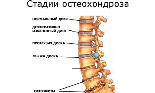Беспокоит боль в легких при глубоком вдохе
